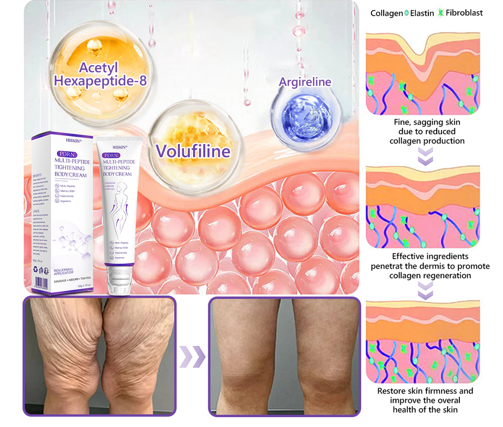 FDA Official: HISKIN® PDRN Multi-Peptide Massaging Body Roller Cream- Anti-aging, Hydrating, Skin Firming & Lifting, Skin Repair, Even Tone, Acne and Dark Spot Treatment, Wart and Mole Removal, and Psoriasis Relief.